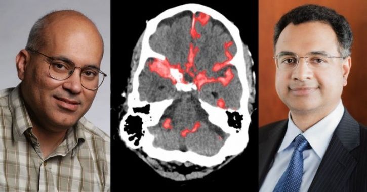 Indian-Origin Doctors Develop AI To Detect Brain Haemorrhage In Seconds ...