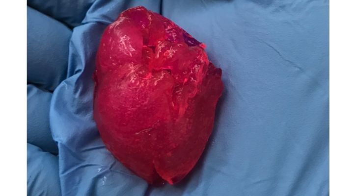 3D Printing Heart
