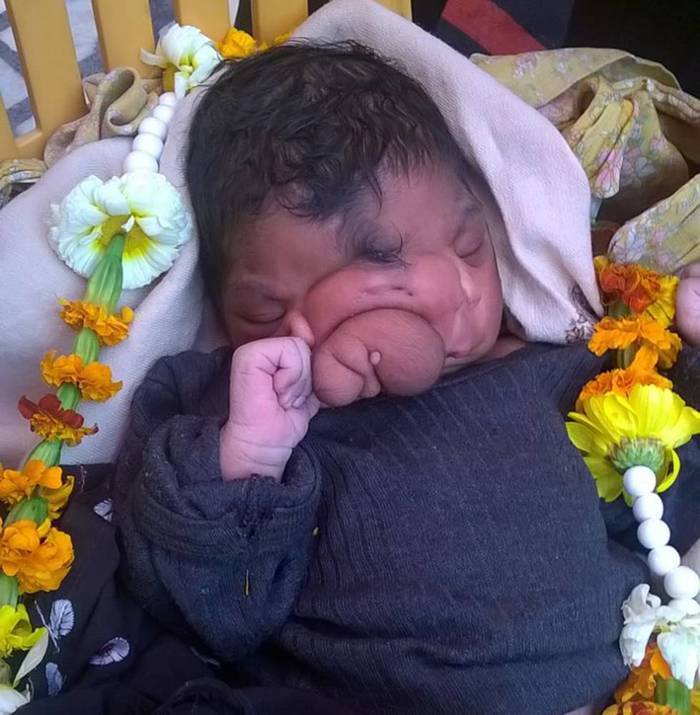Is The Baby Girl Born With A Trunk An Avatar Of Lord Ganesha?