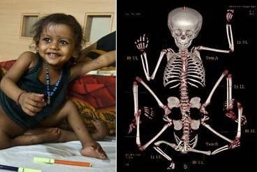 10 Shocking Miracle Stories From India
