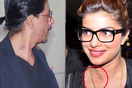 Bollywood Celebrities Caught With Love Bites