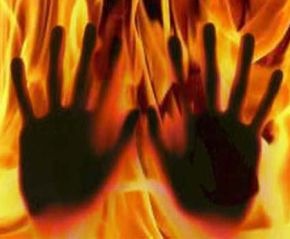 Honour Killing: Girl Burnt Alive By Parents For Dating Uncle