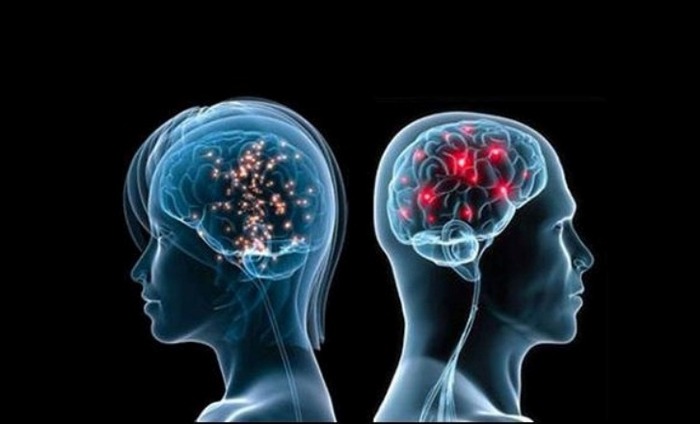 Male And Female Brains React Differently To Stress