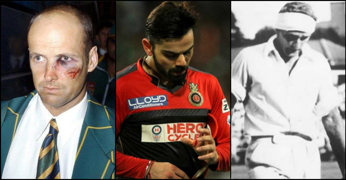 Heroism On The Pitch: When Cricketers Played The Game Despite Injuries!