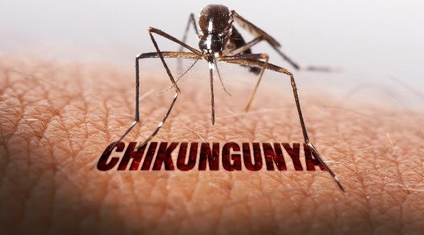 Home Remedies To Treat Chikungunya