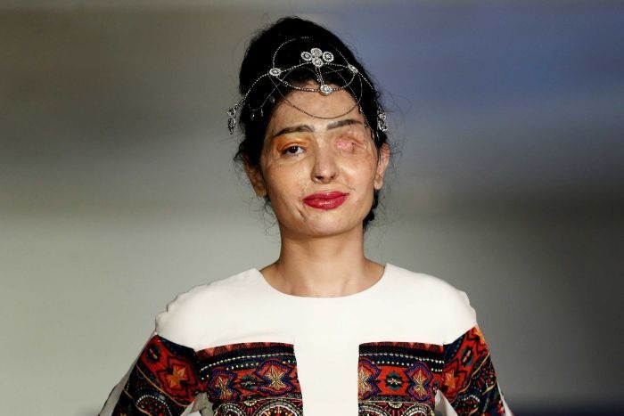 Acid Attack Reshma Quereshi Survivor Stuns The Audience At New York Fashion Week