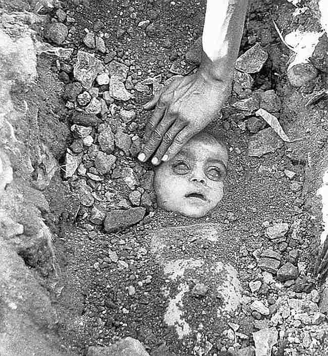 Scars of the Bhopal Gas Tragedy