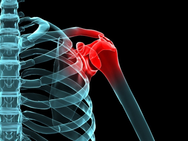 Causes and Treatment of Chronic Shoulder Pain Explained