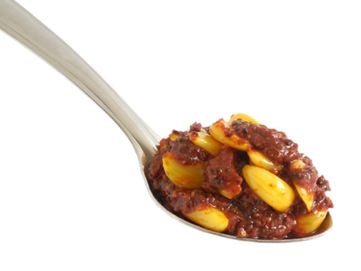 Get Home Remedy For Gastric Problem Pics