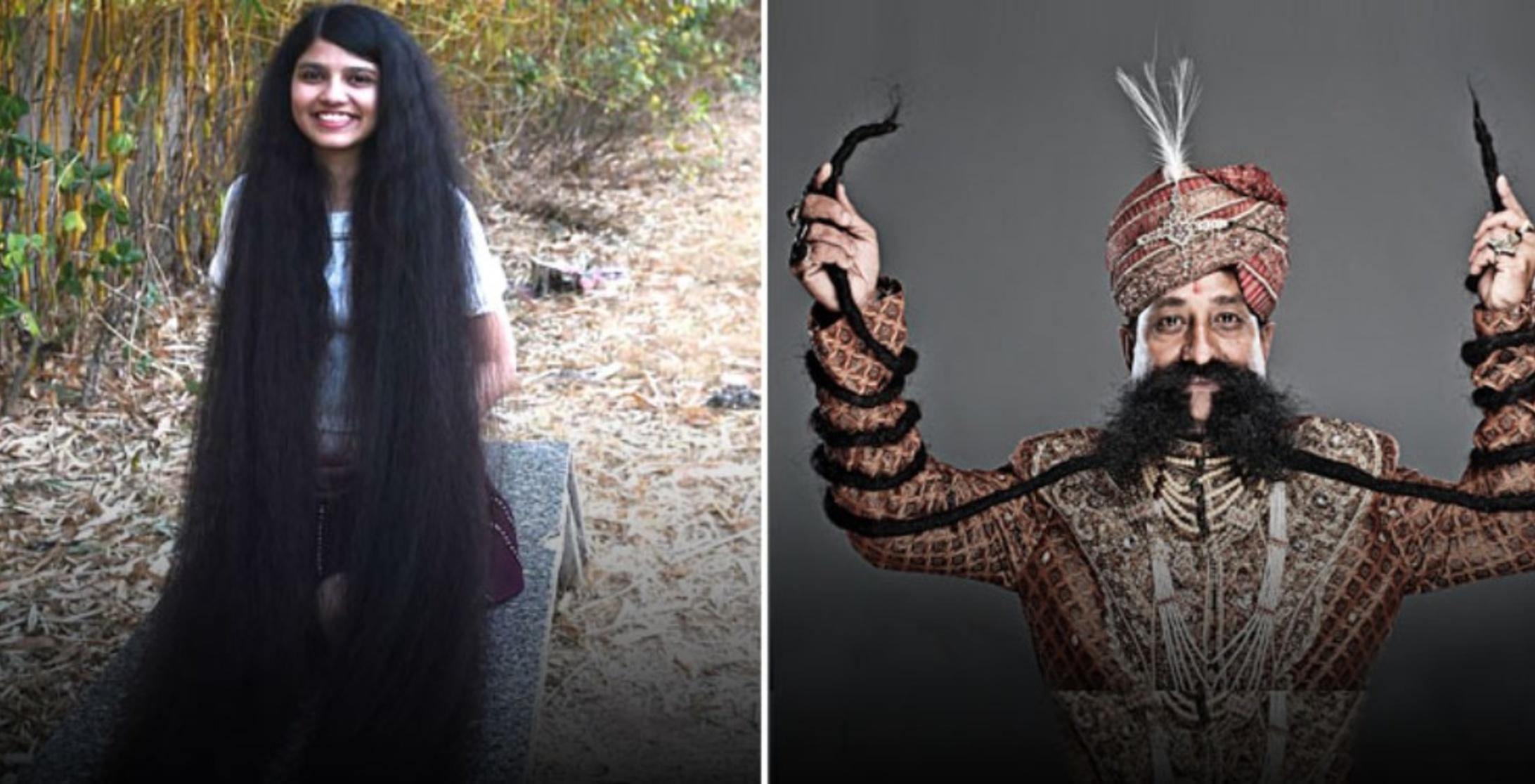 Meet 14 Real People Who Hold World Records For Crazy Physical Irregularities Meet 14 Real People Who Hold World Records For Crazy Physical Irregularities