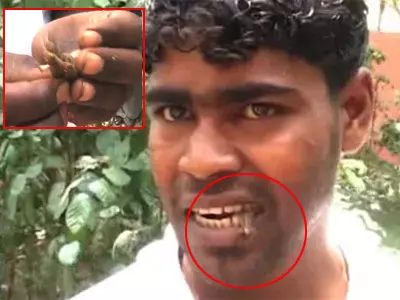 Bizarre: Man Addicted To Eating Insects