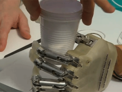 Bionic Hand Gives Sense of Touch